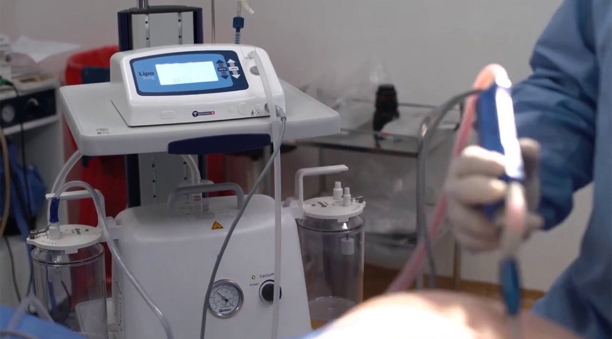 Tecnología para cirugía estética