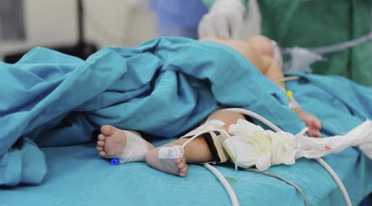 Equipamiento para cirugía pediátrica